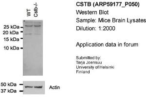 Western Blotting (WB) image for anti-Cystatin B (Stefin B) (CSTB) (N-Term) antibody (ABIN567488) (CSTB antibody  (N-Term))