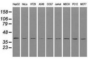 Image no. 2 for anti-CD4 (CD4) antibody (ABIN1497293) (CD4 antibody)