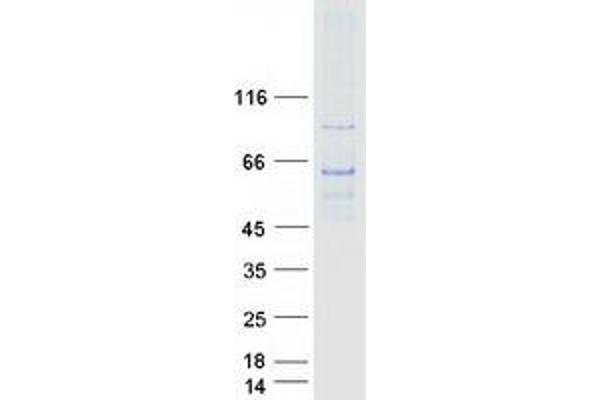 GHDC Protein (Transcript Variant 1) (Myc-DYKDDDDK Tag)