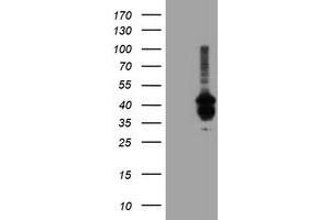 Western Blotting (WB) image for anti-Prenyl (Decaprenyl) Diphosphate Synthase, Subunit 2 (PDSS2) antibody (ABIN1500139) (PDSS2 antibody)