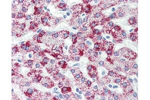 Anti-HSPD1 antibody IHC of human liver. (HSPD1 antibody  (AA 1-573))