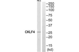 Western blot analysis of extracts from HeLa cells, using CKLF4 antibody. (CKLF antibody  (Internal Region))