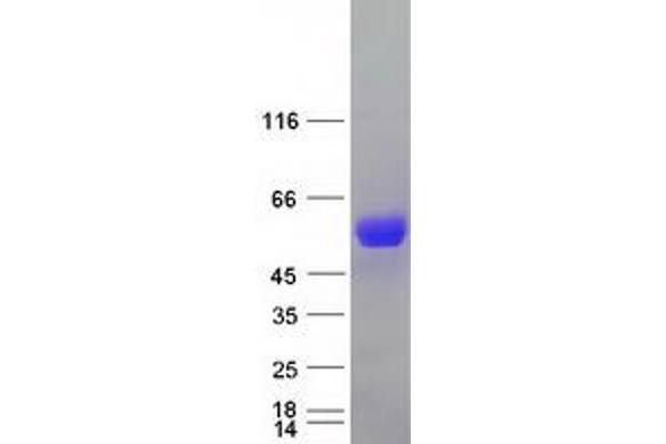 SLC9A3R1 Protein (Myc-DYKDDDDK Tag)