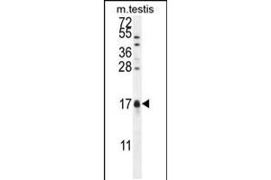 Western blot analysis in mouse testis tissue lysates (35ug/lane). (CAMK2N1 antibody  (C-Term))