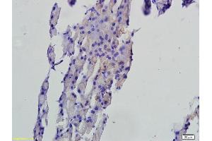 Formalin-fixed and paraffin embedded rat pancreas tissue labeled with Anti-FAF1 Polyclonal Antibody, Unconjugated (ABIN675309) followed by conjugation to the secondary antibody and DAB staining (FAF1 antibody  (AA 551-650))