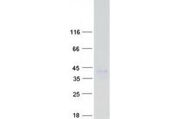 CD1e Protein (CD1e) (Transcript Variant 8) (Myc-DYKDDDDK Tag)