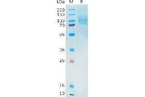 Human Protein, His Tag on SDS-PAGE under reducing condition. (YAP1 Protein (AA 1-504) (His tag))