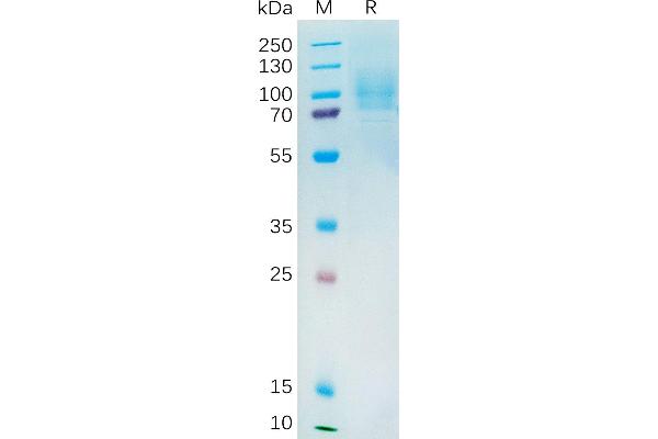 YAP1 Protein (AA 1-504) (His tag)