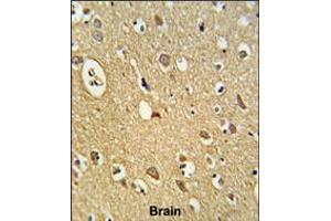 Formalin-fixed and paraffin-embedded human brain tissue reacted with OMD Antibody , which was peroxidase-conjugated to the secondary antibody, followed by DAB staining. (Osteomodulin antibody  (C-Term))