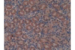 DAB staining on IHC-P; Samples: Mouse Kidney Tissue (Non Metastatic Cells 6, Protein Expressed In (AA 1-184) antibody)