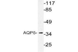 Western blot analysis of AQP5 Antibody in extracts from HUVECcells. (Aquaporin 5 antibody)