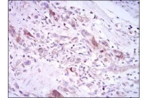 Immunohistochemistry (IHC) image for anti-Polo-Like Kinase 1 (PLK1) (AA 331-508) antibody (ABIN1098105)