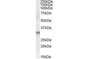 Image no. 1 for anti-Four and A Half LIM Domains 2 (FHL2) (C-Term) antibody (ABIN374413) (FHL2 antibody  (C-Term))