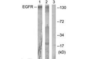 Western Blotting (WB) image for anti-Epidermal Growth Factor Receptor (EGFR) (AA 986-1035) antibody (ABIN2888655) (EGFR antibody  (AA 986-1035))