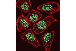 Fluorescent confocal image of U251 cell stained with TADA3L Antibody . (TADA3L antibody  (C-Term))