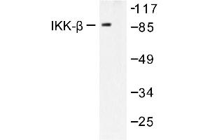 Image no. 2 for anti-Inhibitor of kappa Light Polypeptide Gene Enhancer in B-Cells, Kinase beta (IKBKB) antibody (ABIN271895) (IKBKB antibody)