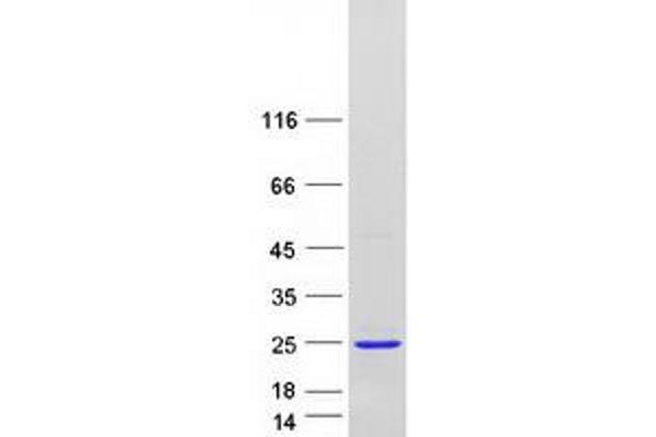 NUDT2 Protein (Transcript Variant 2) (Myc-DYKDDDDK Tag)