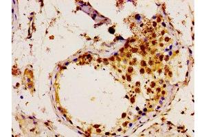 Immunohistochemistry of paraffin-embedded human testis tissue using ABIN7174468 at dilution of 1:100 (UBE2L3 antibody  (AA 1-154))