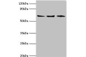 Western blot All lanes: ACAD9 antibody at 6 μg/mL Lane 1: MCF-7 whole cell lysate Lane 2: 293T whole cell lysate Lane 3: K562 whole cell lysate Secondary Goat polyclonal to rabbit IgG at 1/10000 dilution Predicted band size: 69 kDa Observed band size: 69 kDa (ACAD9 antibody  (AA 1-270))