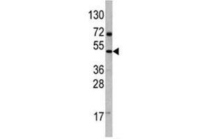Western blot analysis of VEGFD antibody and 293 lysate (VEGFD antibody  (AA 322-352))