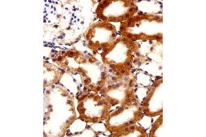 Immunohistochemical analysis of paraffin-embedded R. (FBXL17 antibody  (C-Term, Isoform 2))