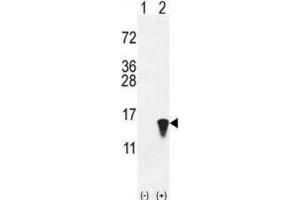 Western Blotting (WB) image for anti-ISG15 Ubiquitin-Like Modifier (ISG15) antibody (ABIN2996231) (ISG15 antibody)