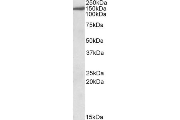 EPB41L3 antibody  (C-Term)