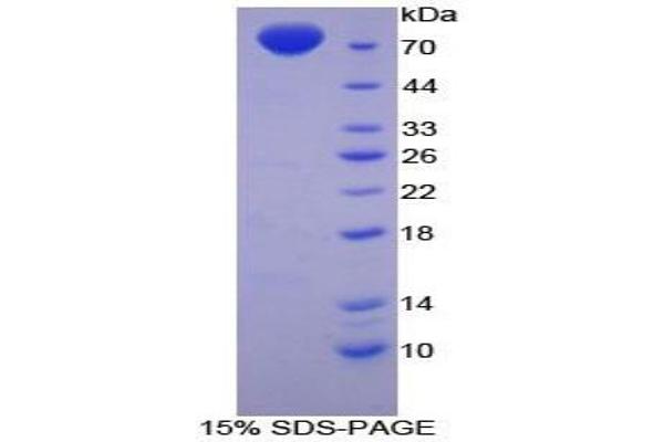 MSE Protein