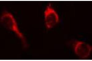 ABIN6267652 staining A431 cells by IF/ICC. (PKC mu antibody  (pTyr463))