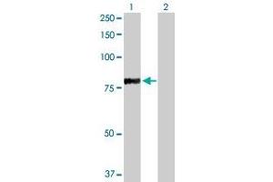 Western Blotting (WB) image for RFX5 293T Cell Transient Overexpression Lysate(Denatured) (ABIN1333304)