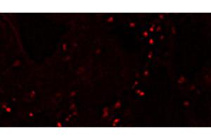 Frozen skin section from piglets immunized with an inactivated chimeric PCV1-2 vaccine post intradermal injection with PCV2 antigen was stained with Mouse Anti-Porcine CD4-PE (CD4 antibody  (PE))