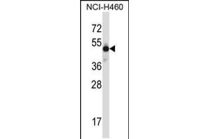 Western blot analysis in NCI-H460 cell line lysates (35ug/lane). (MKX antibody  (N-Term))