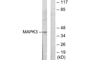 Western blot analysis of extracts from COLO205 cells, using MAPK3 antibody. (ERK1 antibody  (C-Term))