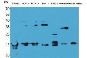 Western Blotting (WB) image for anti-MK (Internal Region) antibody (ABIN3178208) (MK (Internal Region) antibody)