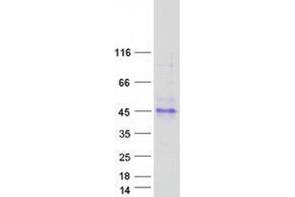 TMIGD1 Protein (Myc-DYKDDDDK Tag)