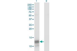 Western Blot analysis of PF4 expression in transfected 293T cell line by PF4 monoclonal antibody (M01), clone 3F6. (PF4 antibody  (AA 31-101))