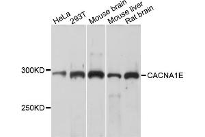 Western blot analysis of extracts of various cell lines, using CACNA1E antibody (ABIN4903099) at 1:1000 dilution. (CACNA1E antibody)