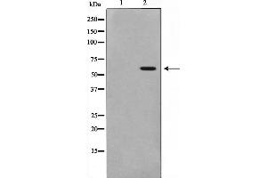 Western blot analysis on K562 cell lysate using Phospho-MAPKAPK5(Thr182) Antibody,The lane on the left is treated with the antigen-specific peptide. (MAPKAP Kinase 5 antibody  (pThr182))
