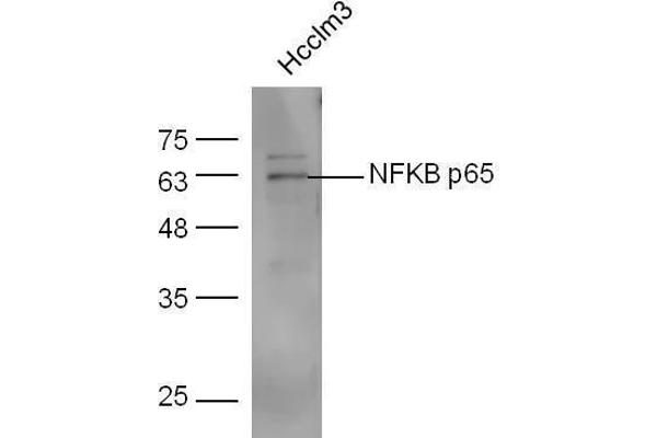 NF-kB p65 antibody  (AA 51-100)