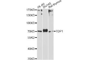 Western blot analysis of extracts of various cell lines, using TDP1 Antibody (ABIN6290989) at 1:1000 dilution. (TDP1 antibody)