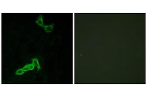 Immunofluorescence analysis of MCF-7 cells, using GPR137C antibody. (GPR137C antibody  (Internal Region))