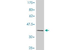 Western Blot detection against Immunogen (37. (MAP3K14 antibody  (AA 847-947))