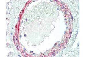 IHC testing of FFPE human small intestine tissue with VPS35 antibody at 5ug/ml. (VPS35 anticorps)