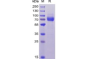 Human CD33, hFc-His Tag on SDS-PAGE under reducing condition. (CD33 Protein (CD33) (AA 18-259) (Fc-His Tag))