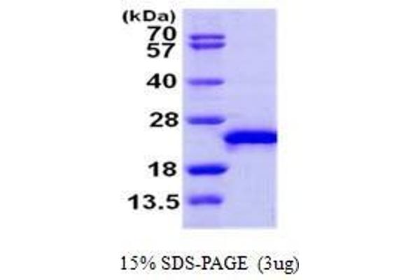 RAC3 Protein (AA 1-189)