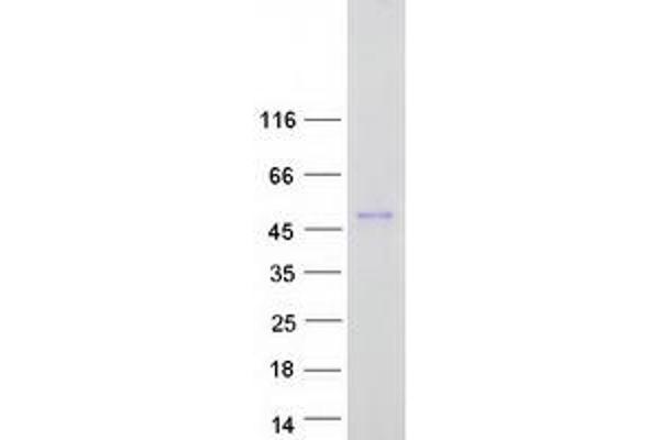 ALX3 Protein (Myc-DYKDDDDK Tag)