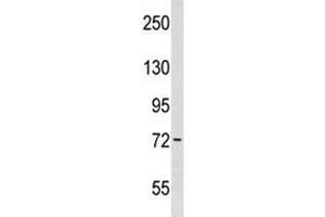 Wee1 antibody western blot analysis in WiDr lysate. (WEE1 antibody  (AA 202-230))