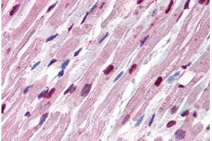 Human Heart (formalin-fixed, paraffin-embedded) stained with Tubulin, Alpha 1 (TUBA1) antibody ABIN239816 at 10 ug/ml followed by biotinylated anti-mouse IgG secondary antibody ABIN481714, alkaline phosphatase-streptavidin and chromogen. (alpha Tubulin antibody)