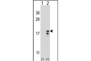 Western blot analysis of COX6A1 (arrow) using rabbit polyclonal COX6A1 Antibody (Center) (ABIN653100 and ABIN2842691). (COX6A1 antibody  (AA 50-78))