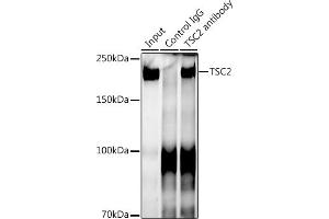 Immunoprecipitation analysis of 300 μg extracts of 293T cells using 3 μg TSC2 antibody (ABIN7271027). (Tuberin antibody)